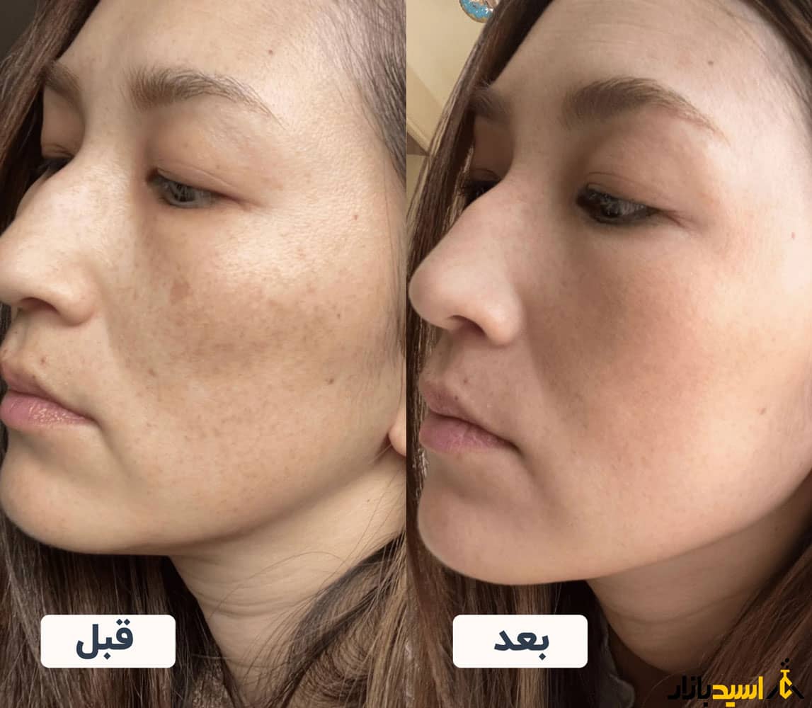 کاهش چین و چروک پوست کاهش چین و چروک پوست از فواید مصرف پودر کلاژن