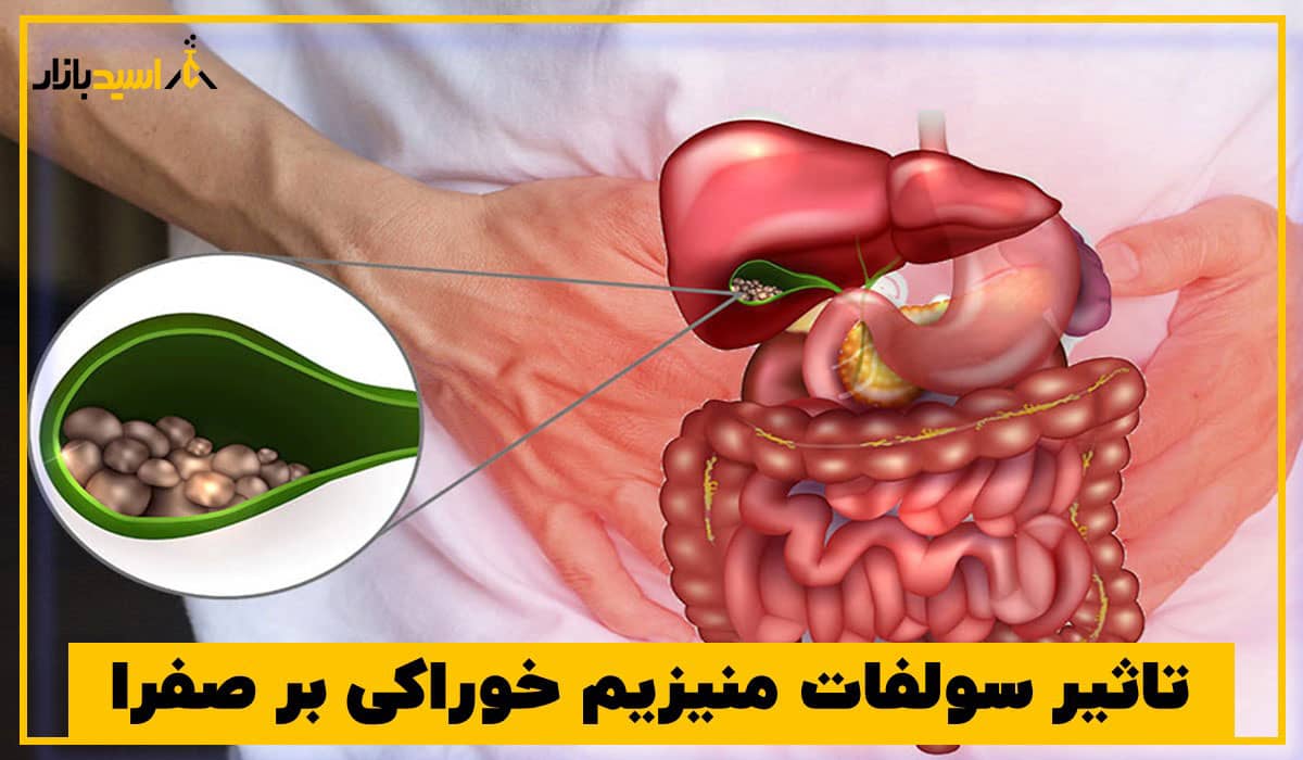 تاثیر سولفات منیزیم بر صفرا تاثیر سولفات منیزیم بر صفرا